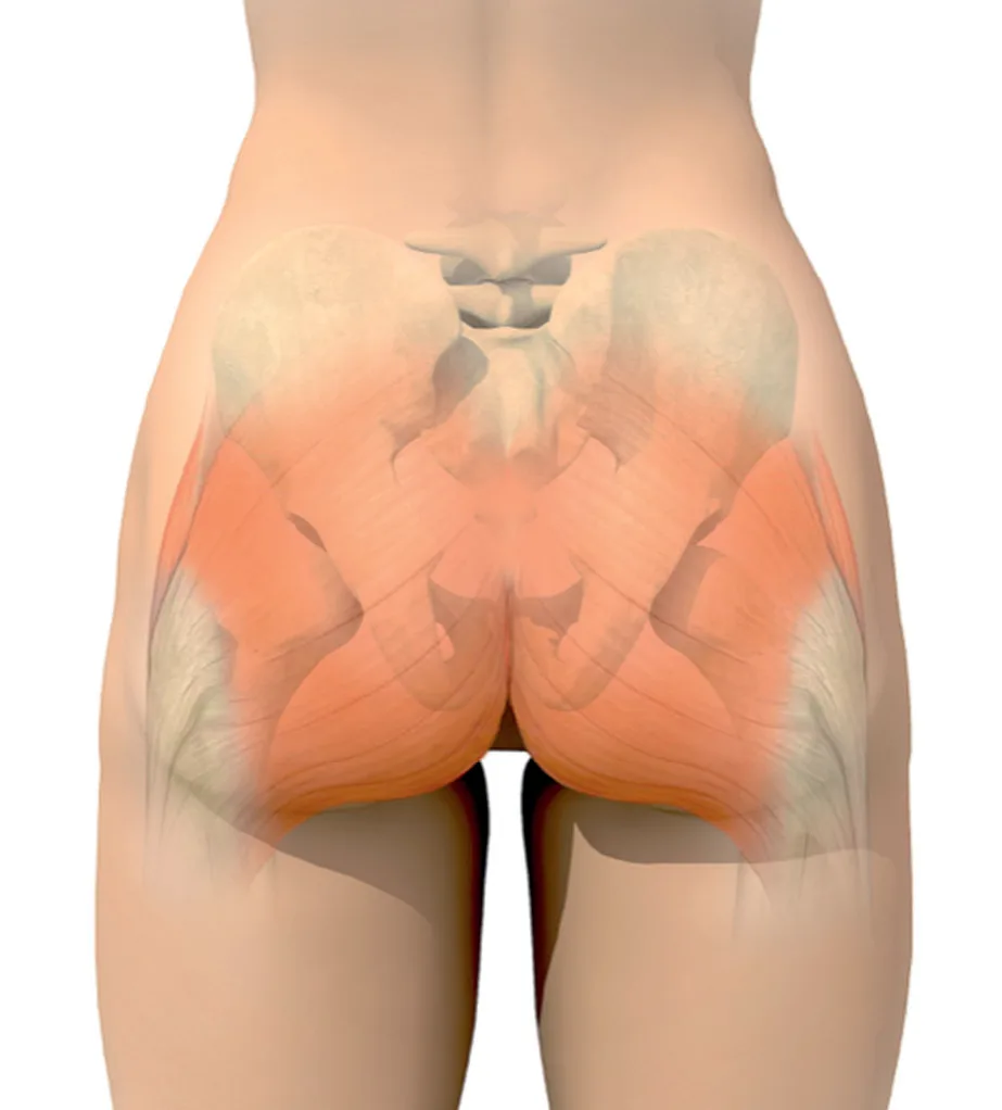 Fig 5. Posterior view of the female gluteal region: pelvic landmarks and the gluteal muscle mass ("dangerous triangle") that intramuscular injection must avoid.